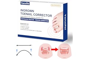 Nitinol Ingrown Toenail Corrector,at Home Ingrown Toenail Treatment,Curved Toenail Straightener,Ingrown Toe Nail Relief，Ingro
