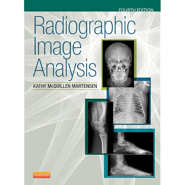Workbook for Radiographic Image Analysis: 9780323280716: Medicine