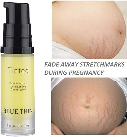 Amazon Com Striae Gravidarum Repair Fheaven Tm 6ml Removal Acne Scar Stretch Marks Cream Fat Scar Striae Gravidarum Treatment 6ml Musical Instruments