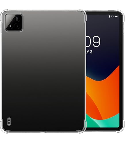 Amazon.com: Case for Xiaomi Pad 7/7 Pro 11.2 Inch, Compatible with