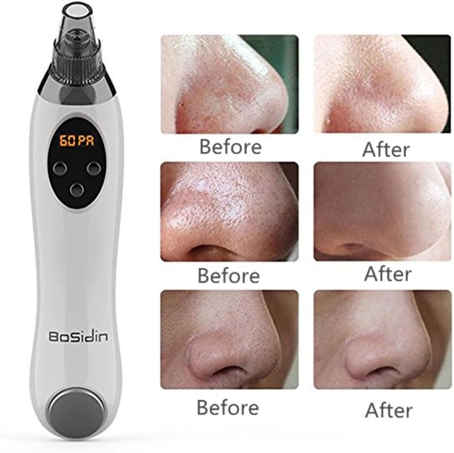 Blackhead Remover Facial Pore Cleaner-Exclusively includes Ice Cool fuction to shrink the pores-Can reduces wrinkle&acne for fresher younger skin