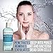 Acne Treatment: Anti Acne Deep Pore Cleansing Astringent Toner. Clears Acne. Reduce Blemishes & Redness. Salicylic Acid & Niacinamide Vitamin B3 for Healthier, Youthful Glow. 6 oz