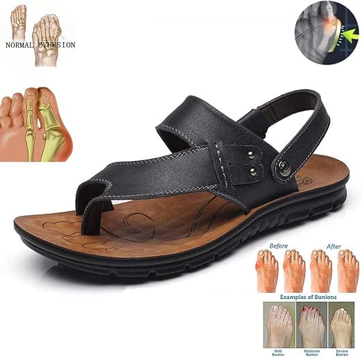 sandals with arch support for bunions