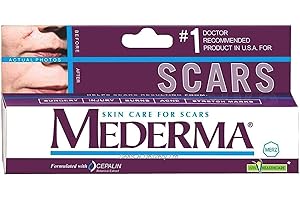 Mederma Skin Care (Helps Scars -Surgery, Injury, Burns, Acne,Stretch marks)