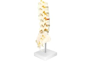 QWORK Life-Size Human Spine Model with 5 Lumbar Vertebrae and Herniation Discs - Ideal for Medical Teaching and Scientific Classroom
