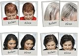 3D Hair Fibres 35g Medium Brown Keratin Protein for Thinning Hair Men Women view 5