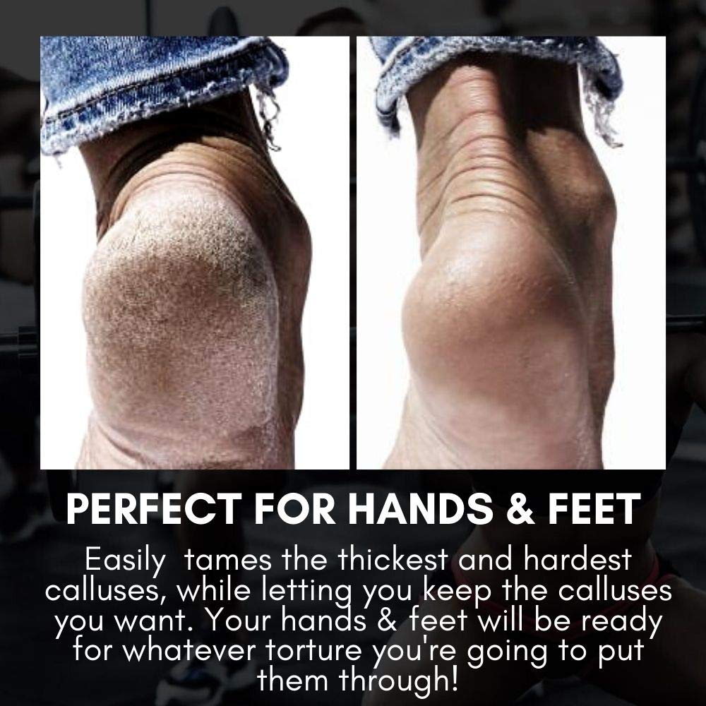 SandBar - Original Callus Remover | The Ultimate Callus Tool for Hands and Feet - Includes Salve (Pink) : Beauty