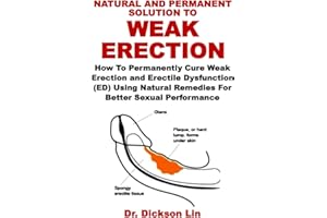 NATURAL AND PERMANENT SOLUTION TO WEAK ERECTION: How To Permanently Cure Weak Erection and Erectile Dysfunction (ED) Using Na