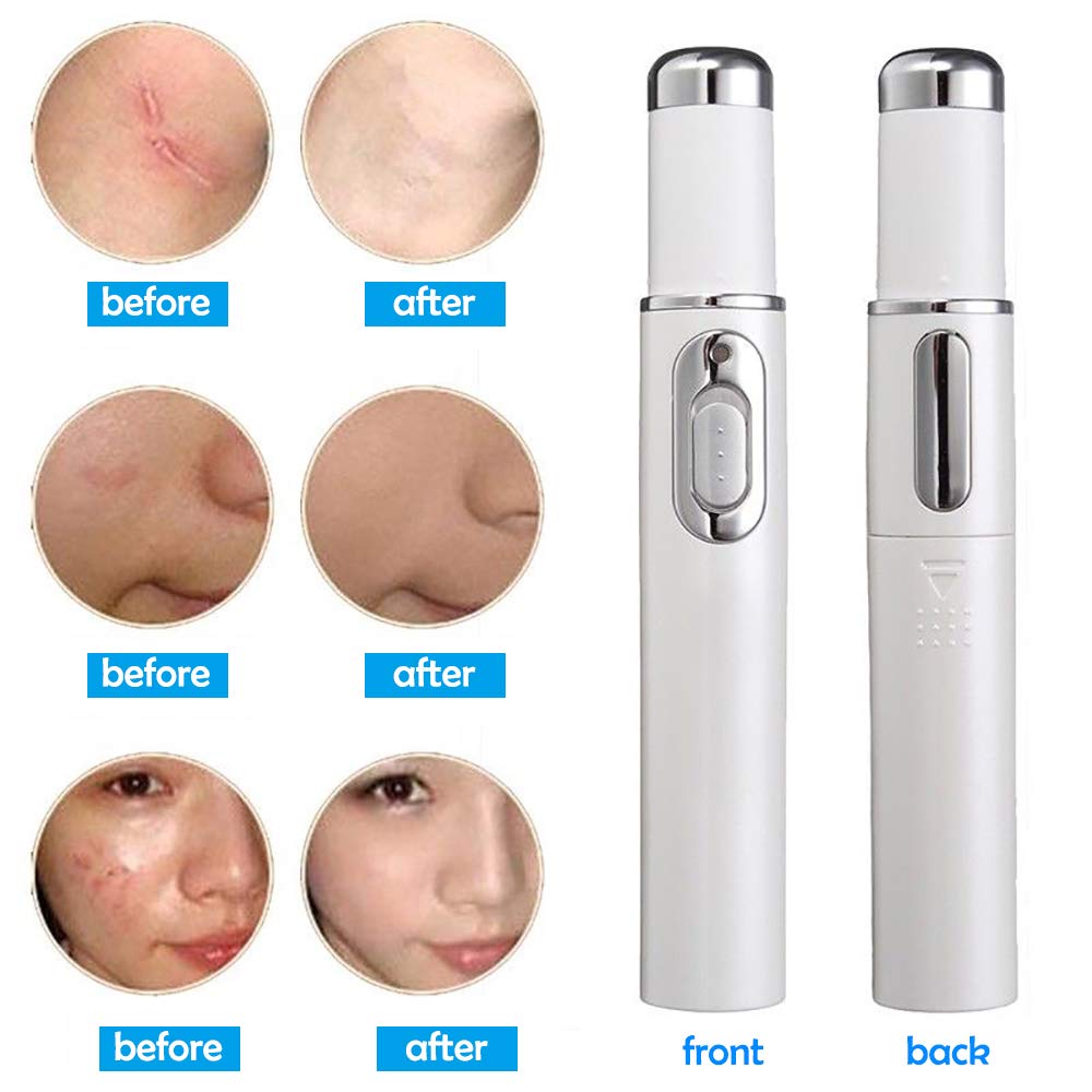 Enshey Blue Light Therapy Pen Soft Portable Treatment Massager Device For Scar Wrinkle Removal Tighten Skin Amazon In Health Personal Care