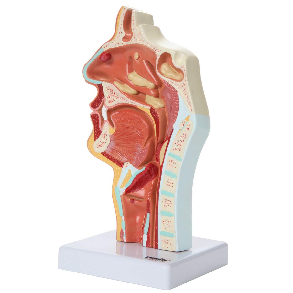 Axis Scientific Human Larynx and Pharynx Disorders Model | Shows Normal Larynx and Pharynx Anatomy and Details Common Abnormalities | Comes on White Base