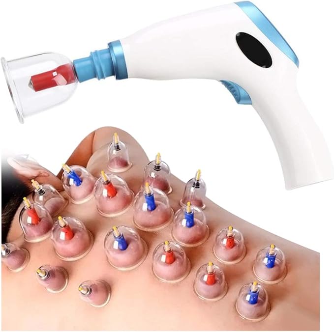best cupping therapy kit