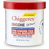 Chiggerex 2X Power First Aid Medicated Ointment for Chiggers, Mosquito Bites, Ticks and Bug Bite Relief with Aloe Vera & Chamomile, 6 oz