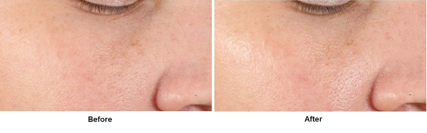 dr dennis gross alpha beta pore perfecting serum