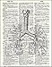 Fresh Prints of CT Human Lungs - Dictionary Art Print Printed On Authentic Vintage Dictionary Book Page - 8 x 10.5