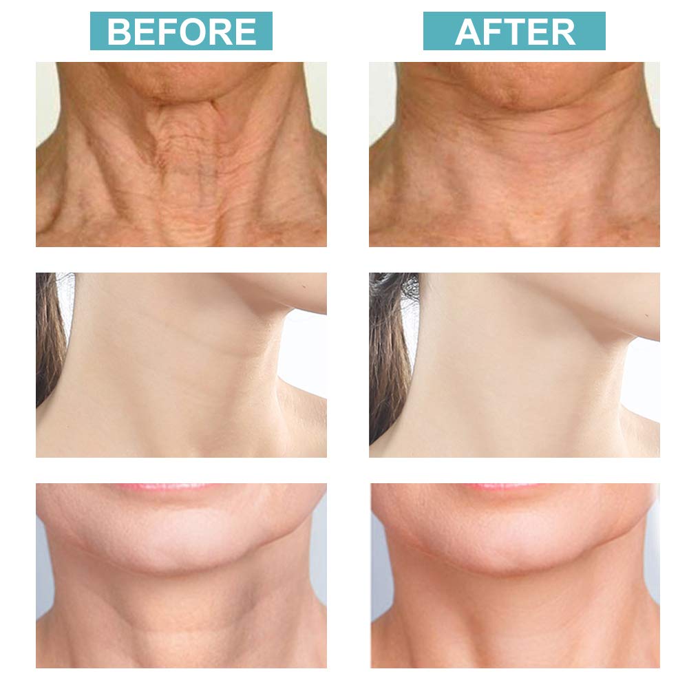 Neck Firming Cream, Neck Tightening Cream, Anti Aging ＆ Wrinkle Neck Cream, Skin Tightening, Helps Double Chin, Turkey Neck Tightener, Repair Crepe Skin: Beauty
