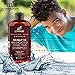 Art Naturals 2 Pack - Scalp18 Coal Tar Therapeutic Anti Dandruff Shampoo 16 oz - Helps clear symptoms of Psoriasis, Eczema, Itchy Scalp & Dandruff - Made in USA with Natural & Organic Ingredients