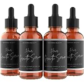Rennora Hair Growth Serum with Peppermint, Nettle &amp; Rosemary Oil (4 Pack) | Organic Herbs &amp; Vitamins, Peppermint, Nettle &amp; Rosemary Oil - No Chemicals - Hair Regrowth Formula (4 Pack, 120 Days)