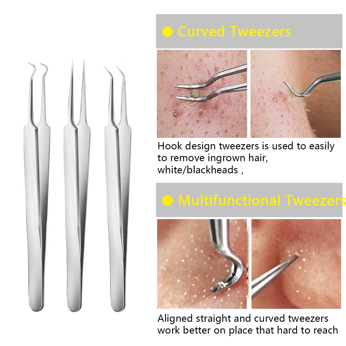 Blackhead Remover Acne Tool 9PCS Kit, Aooeou Professional Stainless Steel Curved Pimple Tweezers Comedone Extractor Instrument Tool Set for Curing Facial Blemish Whitehead: Beauty