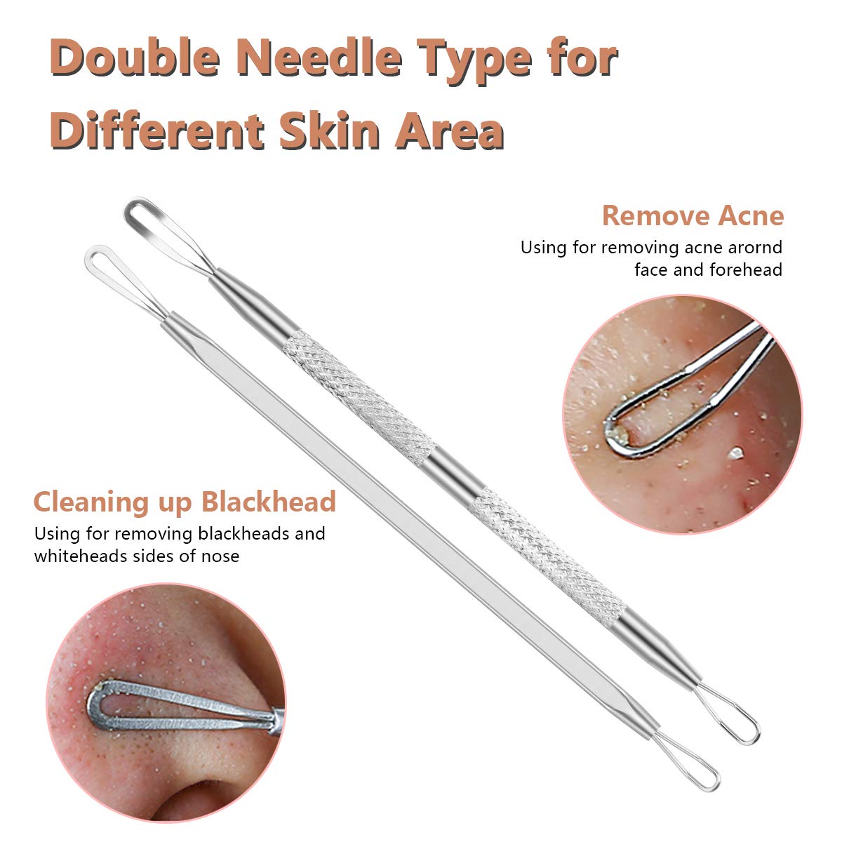 Pimple Popper Tool Kit,Blackhead Remover kit,christmas gifts Stocking Stuffers 6 PCS Ingrown Hair Removal Kit,White heads Removers,Pore Extraction Tool,Facial Skin Acne Zit Tools With A Leather Bag: Beauty