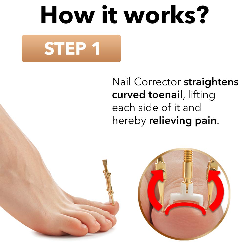 Dr. Krause Ingrown Toenail Treatment Kit 20Pcs/set - Stainless Steel Pedicure Tools for Nail Correction, Softening and Easy Trimming - Nail Corrector, Tweezers, 6x Headers, 12x Nail Retainers: Beauty