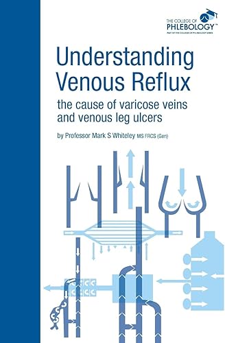 Download Understanding Venous Reflux the Cause of Varicose Veins and Venous Leg Ulcers PDF