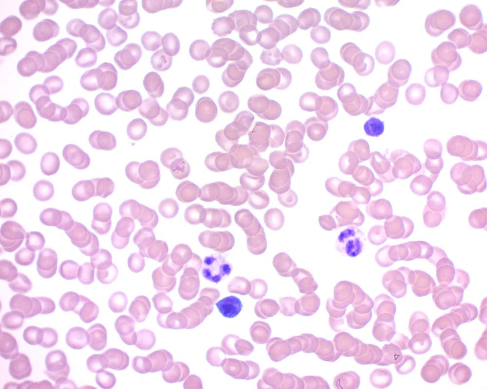 QuickDip Differential Stain Pack, 1000ml Industrial