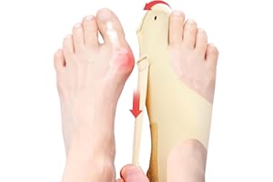 RUSHFORWARD 2 Pcs Bunion Corrector & Adjustable Toe Spacer for Women & Men-Big Toe Support with Side & Heel Straps, Hallux Valgus Pain Relief, Comfortable for Day & Night. (1, Beige, Medium)