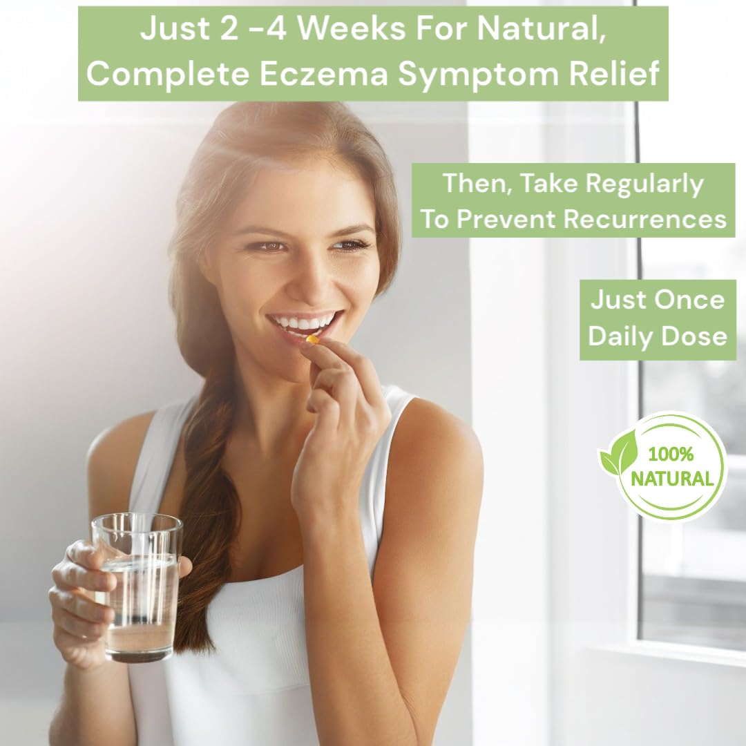 Loma Lux Eczema Pills – Natural Eczema Treatment Relief Remedy – Dermatologist Developed – 7 Minerals Clear & Prevent Severe Eczema Scaling, Rash, Anti Itch Skin Body Face for Adults, Kids, Toddlers