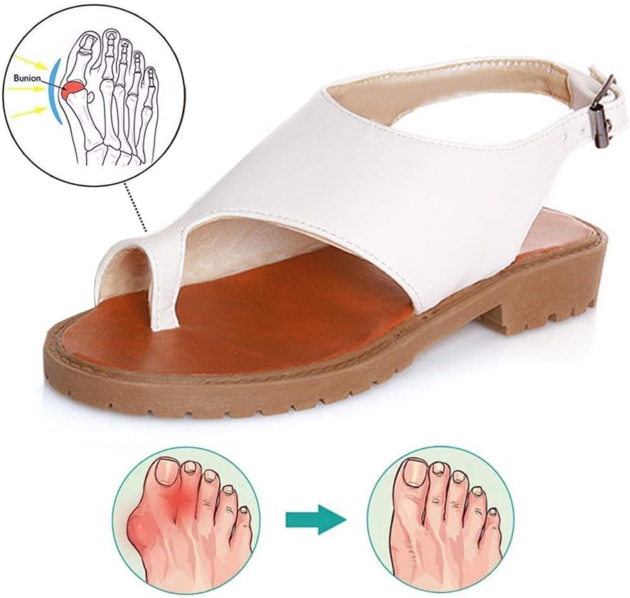 Women Big Toe Bone Overlap Correction Sandals Hallux Valgus Bunion