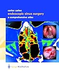 Endoscopic Sinus Surgery: A Comprehensive Atlas