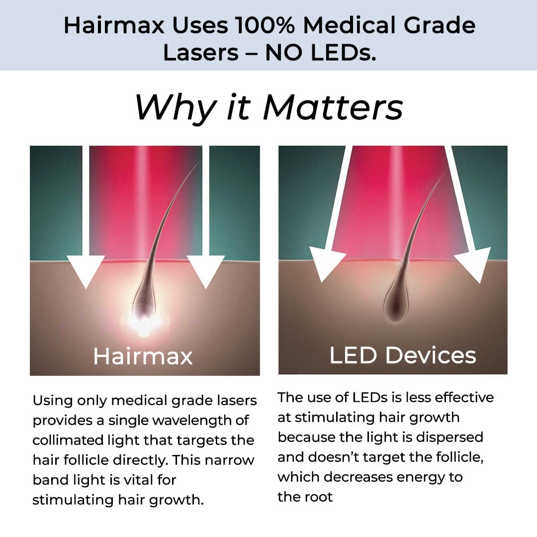 Hairmax LaserBand 82 - Hair Growth and Regrowth Treatment - Restores Natural Hair Cycle - Home-Use Medical Device With Medical Grade Lasers
