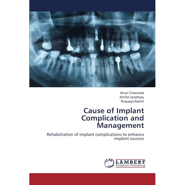 ITI Treatment Guide: Implant Therapy in the Esthetic Zone for