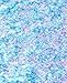 Chunky Cosmetic Holographic Glitter I Body, Face & Hair Safe I 16 pack + 1 glitter primer (festival)