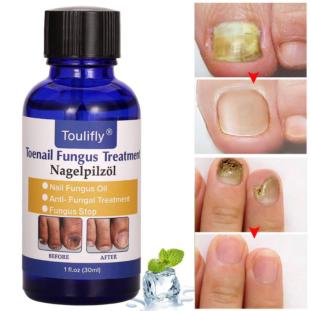 Nail Repair, Nail Solution, Natural Nail Treatment, Effective Against Nail Infection Restores Discolored & Damaged Nails : Beauty