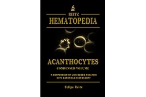 Acanthocytes - Condensed Volume: A Compendium of Live Blood Analysis with Darkfield Microscopy