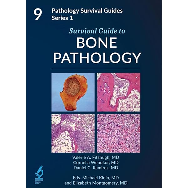 Survival Guide to Thoracic Pathology【新品】 Survival Guide to Thoracic Pathology: Sanjay Mukhopadhyay