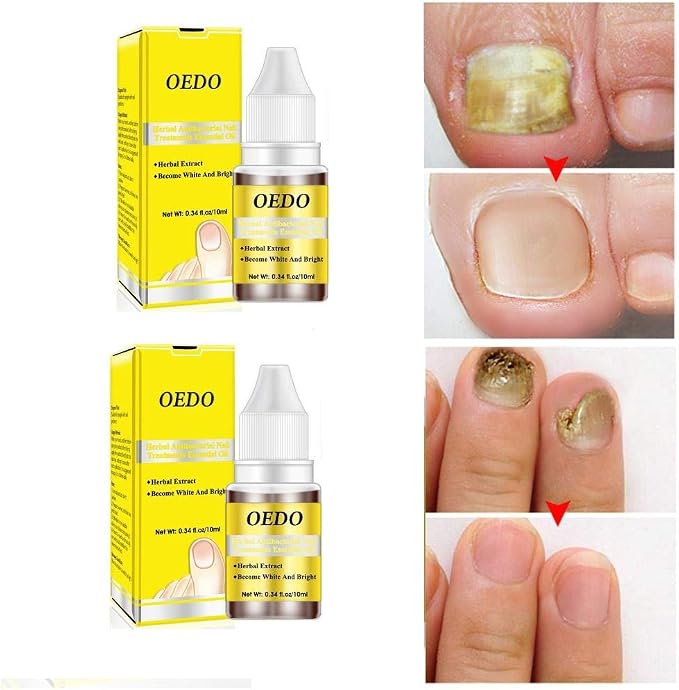 Amazon Co Jp ネイル補修液 10ml 足爪用補修液 ネイルケアオイル 割れる爪に浸透 キューティクルオイル 手爪 足爪にしっかり潤いケア 綺麗な爪再生 ネイル美容液 ビューティー