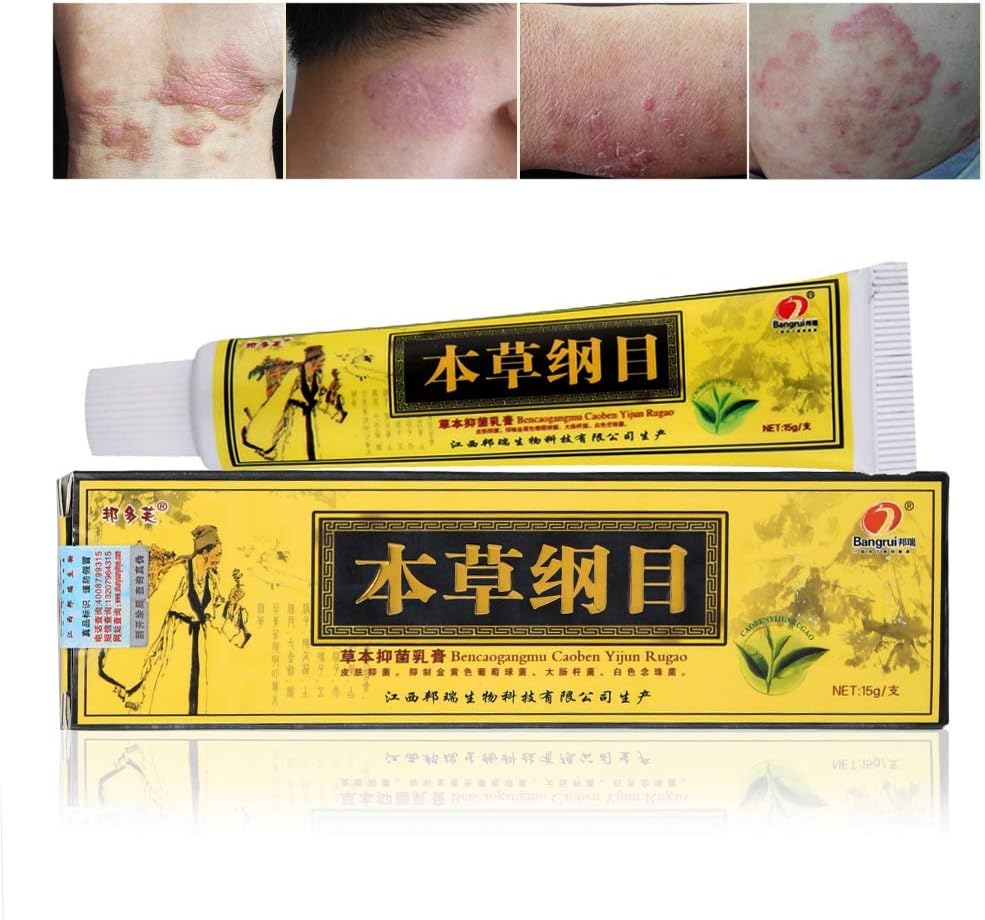 Psoriasis Treatment,Psoriasis Cream for Dermatitis,Chinese Herbal Eczema Reduce Skin Itching, Redness, Anti-inflammatory 15g