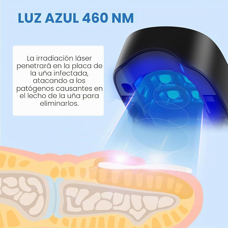 Dispositivo de Limpieza de Hongos en Uñas, Berrlly Dispositivo de Láser de Hongos Uñas 460nm Luz Azul Altamente Efectiva para Hongos en Las Uñas, Fácil de Usar en Casa, Personas Mayores(Negro) — foto 2 de 8