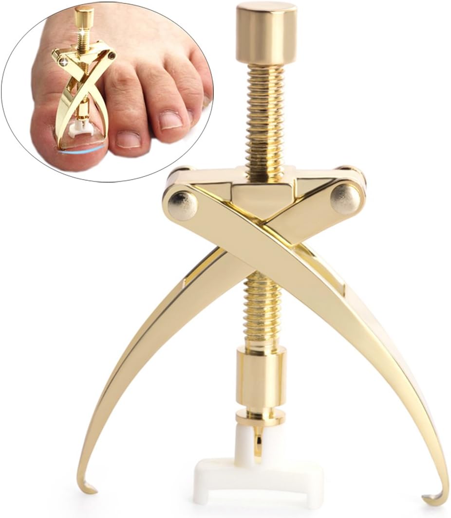 Professional Stainless Steel Ingrown Toe Nail Correction Tool Pedicure Tool: Health & Personal Care