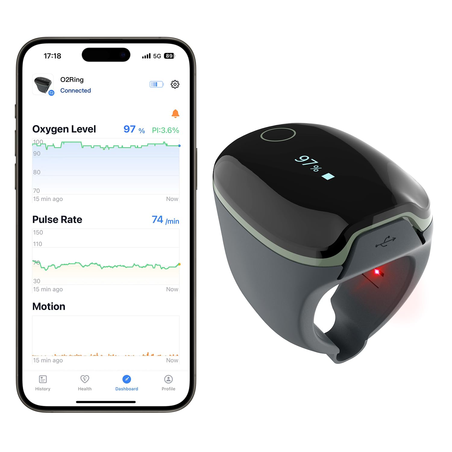 ViATOM O2ring Bluetooth Oximeter, Pulse Oximeter Fingertip for Continuous Monitoring at Night, Sleep Oximeter for Measuring SpO2 & Heart Rate (Premium Card)