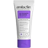 AmLactin KP Bumps Be Gone - Therapeutic Body Cream for Keratosis Pilaris - No-Scrub Exfoliator and Body Moisturizer for Dry Skin with 15% Lactic Acid AHA, 3 oz (Packaging May Vary)