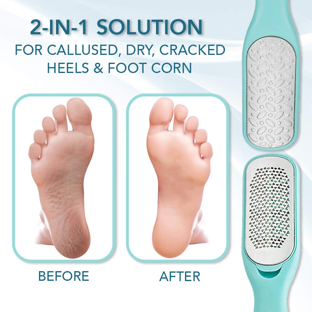 Callus Remover For Feet | Double-sided Dead Skin Remover - Rough Pedicure Foot File For Exfoliation & Fine Foot Scrubber for Smoothing & Softening Skin : Beauty