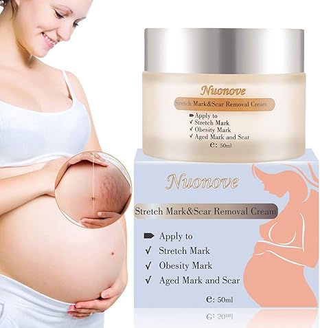 moisturiser for stretch marks