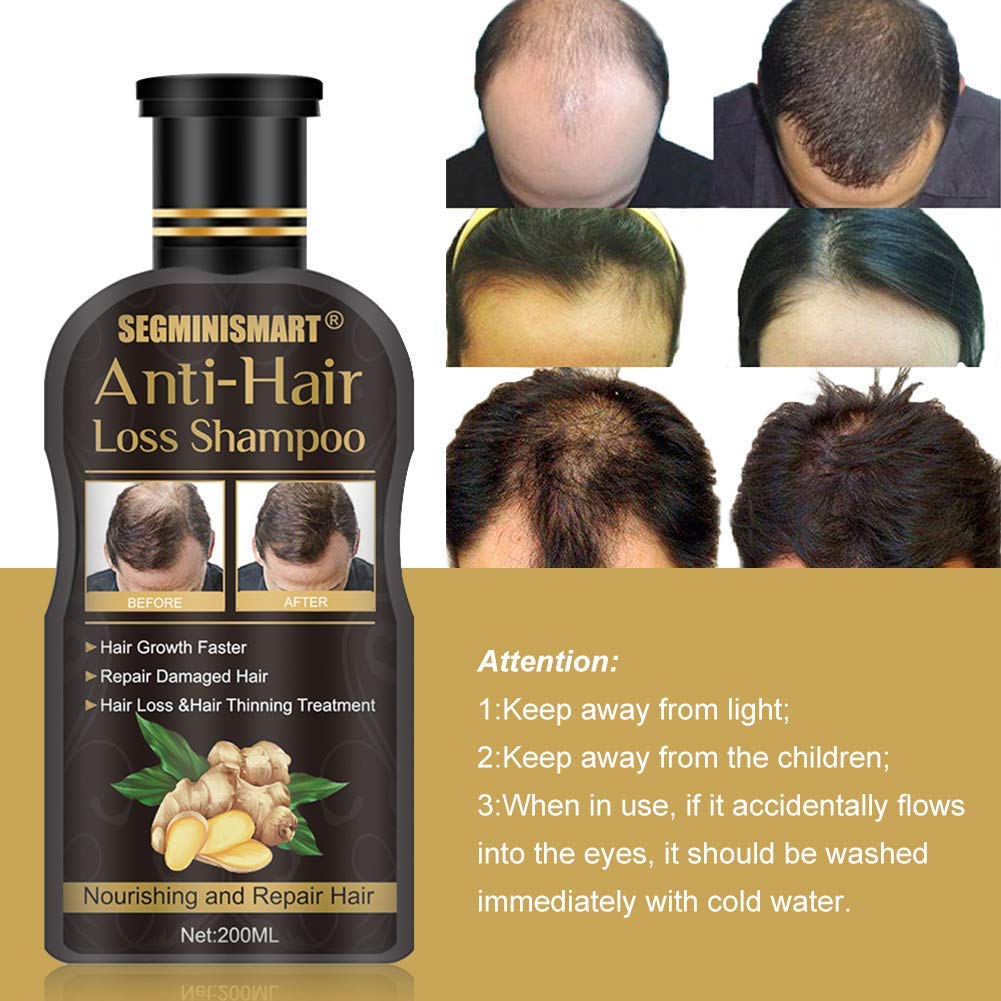 Hair Growth Shampoo,Anti-Hair Loss Shampoo,Hair Loss Shampoo,Hair Thickening Shampoo Helps Stop Hair Loss, Hair Growth for Stronger, Thicker, Longer Hair: Beauty