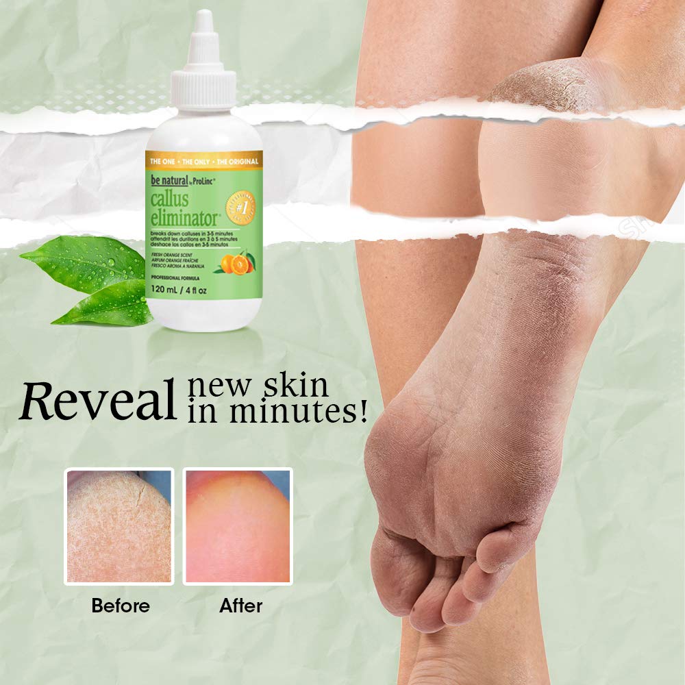 Callus Eliminator orange scent 4oz : Corn And Callus Remover Cushions : Beauty