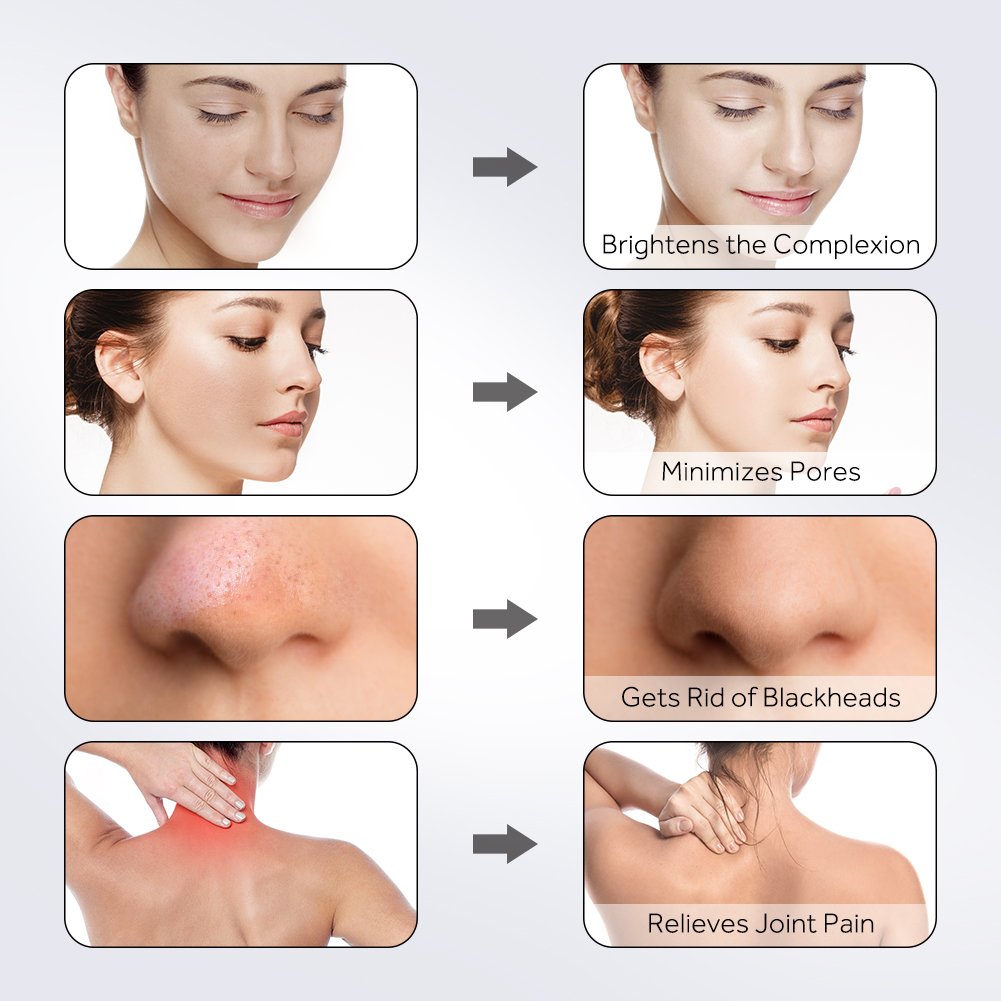 Dead Sea Mud Mask with Activated Charcoal, Deep Cleansing Clay Face Mask for Reduction in Pores, Spots, Blackheads & Acne, Rejuvenated to Smooth & Moisturizing Face, 8.8 fl.oz.