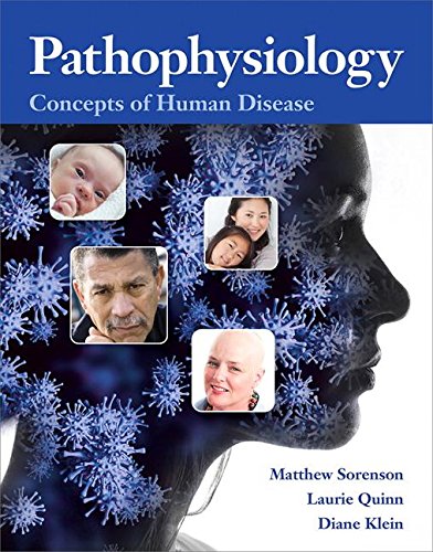 Ebook Pathophysiology: Concepts of Human Disease Plus MyLab Nursing -- Access Card Package<br />W.O.R.D