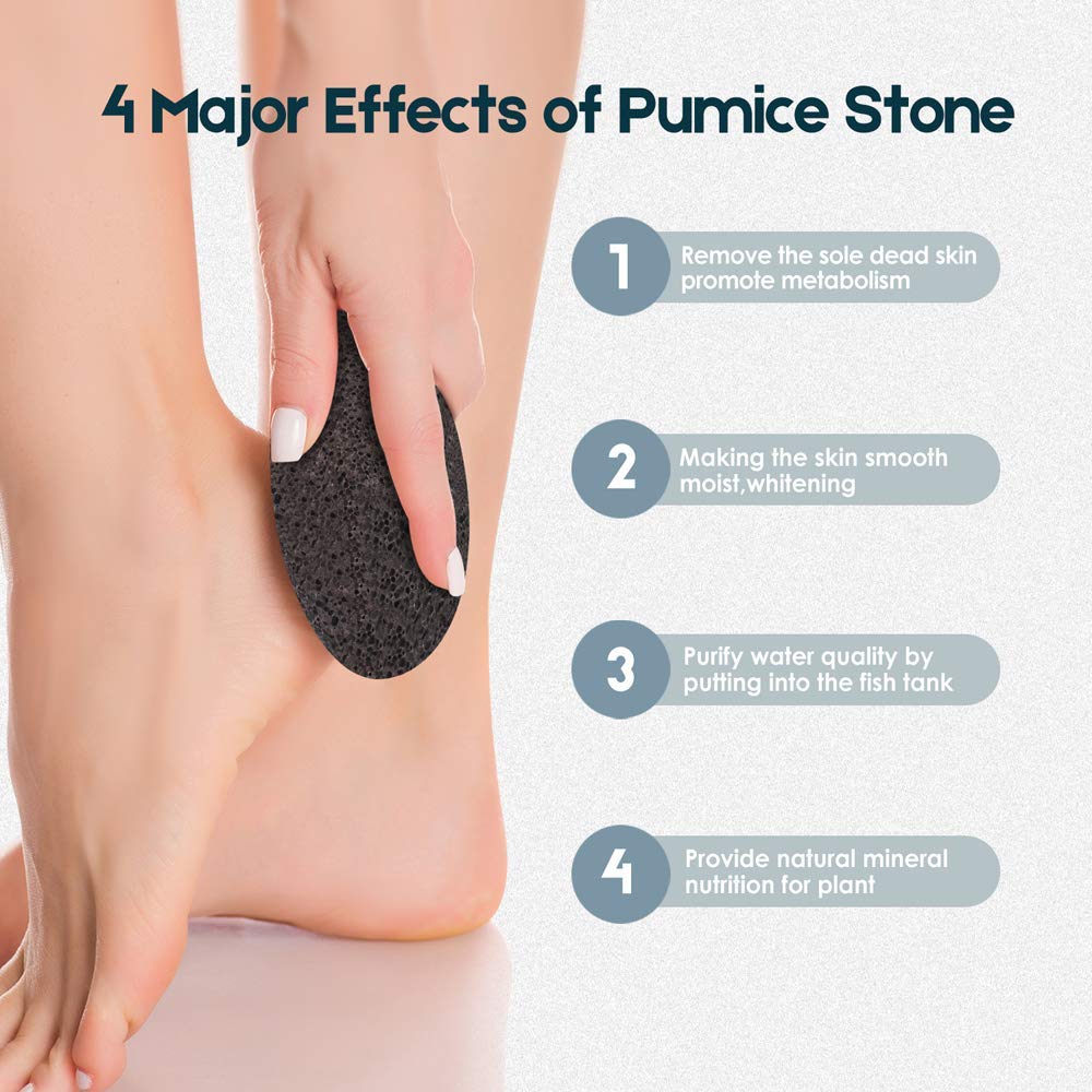 Vridale Pumice Stones for Feet Lava Pumice Stone Foot File Callus Removal Foot Scrubber for Hands Care Foot Exfoliation Dead Skin Remover with Handle: Beauty