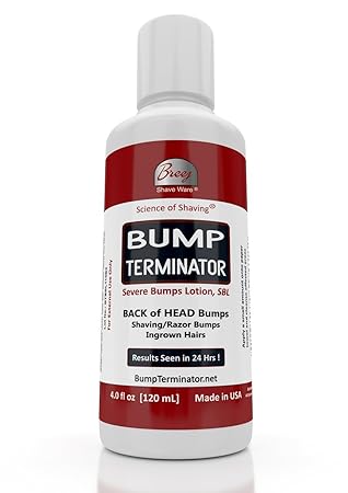 Amazon Com Bump Terminator Severe Bumps Lotion 4oz Beauty